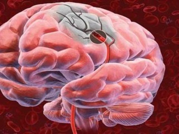 Смерть ради жизни: Учёные открыли новый способ заморозки мозга