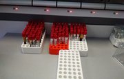 Способные нейтрализовать «омикрон» антитела выявили ученые