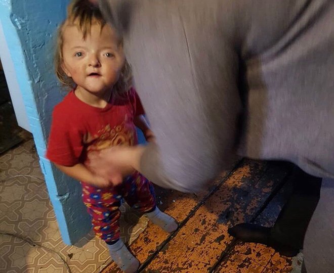 Двухлетнюю девочку-инвалида из глубинки Башкирии положили в больницу