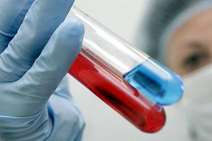 Ученые нашли механизм, обезвреживающий СПИД