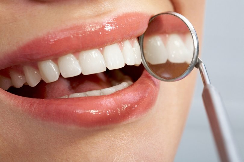 Эстетическая стоматология в Уфе: Как сделать голливудскую улыбку и сколько это стоит? 