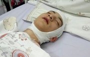 В Башкирии 17-летний сирота после страшного ДТП нуждается в помощи