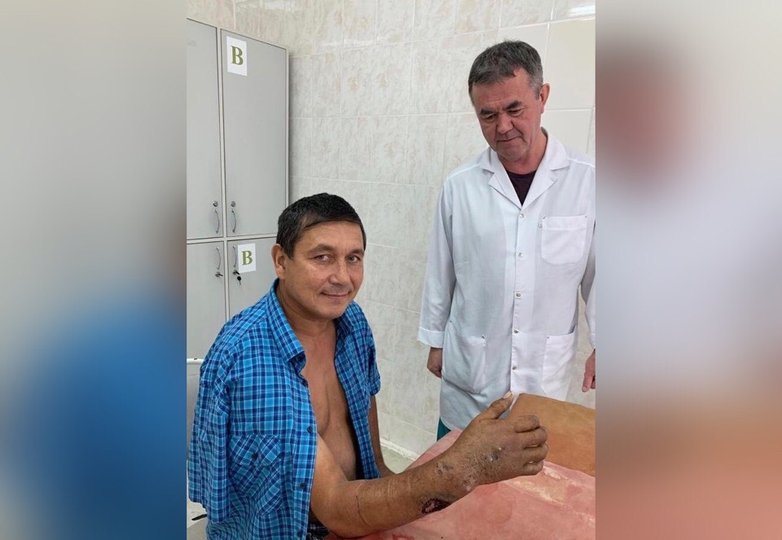Уфимские хирурги спасли попавшую в станок руку многодетного отца
