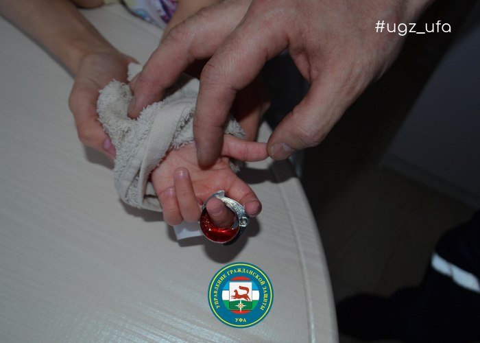 В Уфе палец двухгодовалой малышки застрял в игрушке, на помощь пришли спасатели