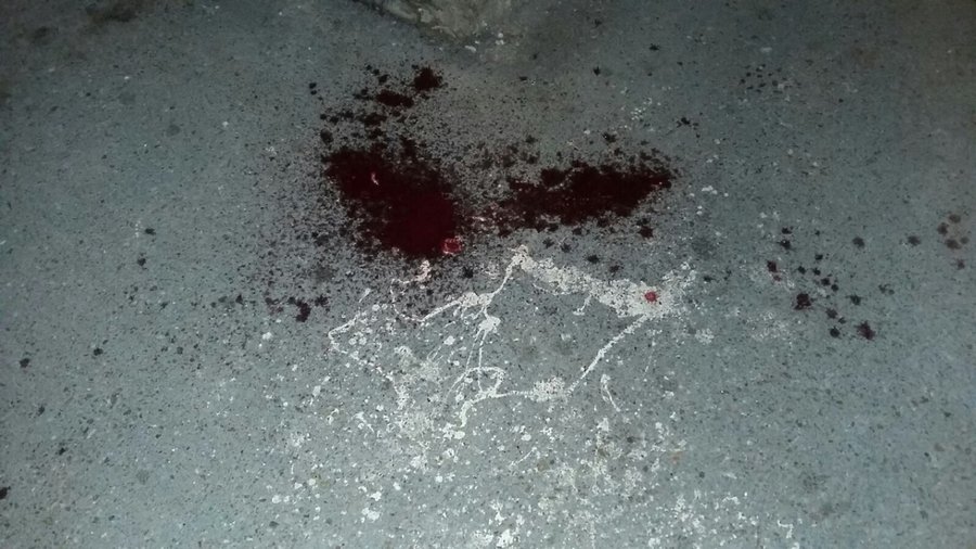 Жительница Башкирии изрезала ножом сожителя за то, что тот выпил без неё бутылку водки