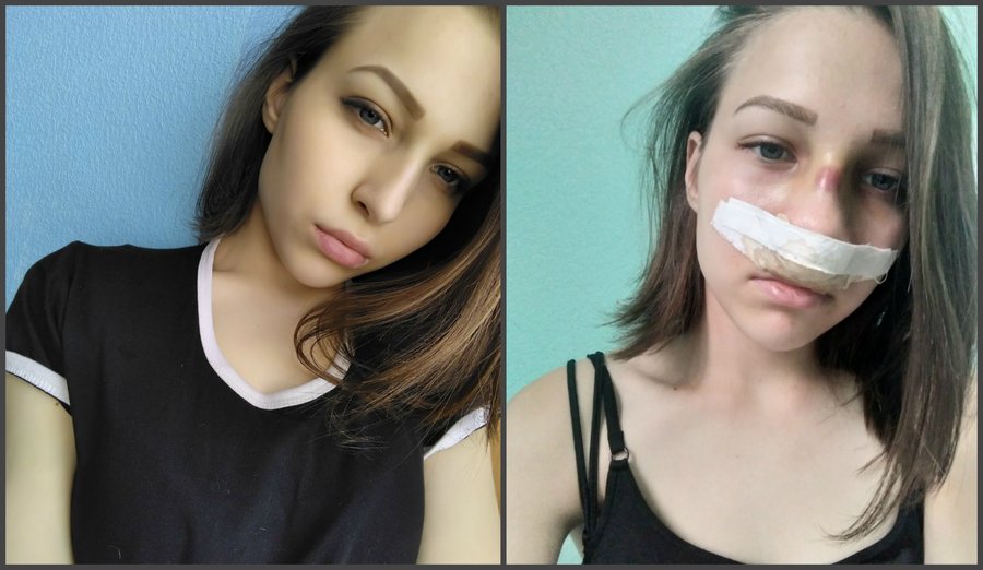 На молодёжном фестивале в Уфе рэпер Gone.Fludd сломал 16-летней девочке нос – Подросток перенёс две операции