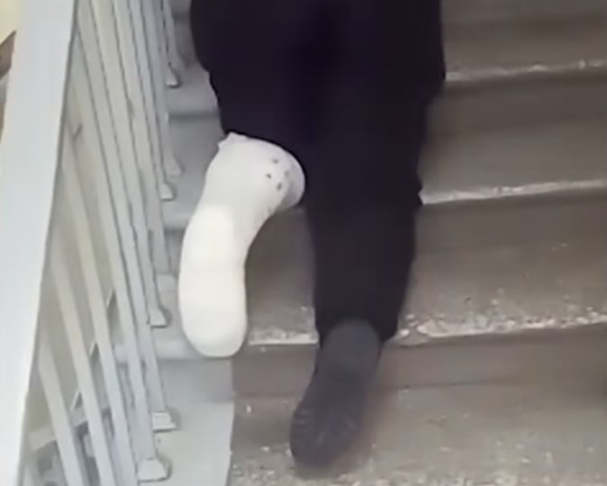 В Уфе пациентка со сломанной ногой была вынуждена ползти к врачу