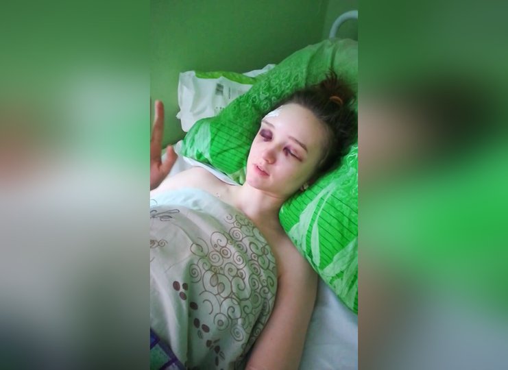 «Лицо сплошной синяк»: В Уфе девушка попала в реанимацию после жуткого ДТП