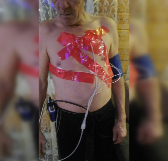 В Башкирии наказали врачей, которые обклеили скотчем пожилого пациента