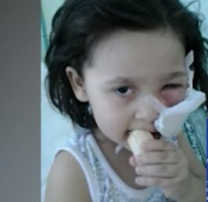 В Башкирии ребенку удалили часть челюсти из-за ошибки стоматолога