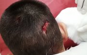 В Башкирии сосулька проломила голову подростка