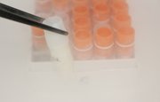 Новое исследование помогло обнаружить коронавирус в сперме пациентов