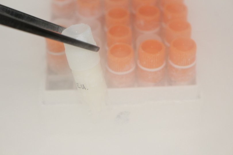 Ученые предостерегли пожилых отцов о генетической опасности их спермы 