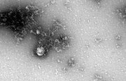 Раскрыто количество вариантов «Дельта»-штамма коронавируса в России