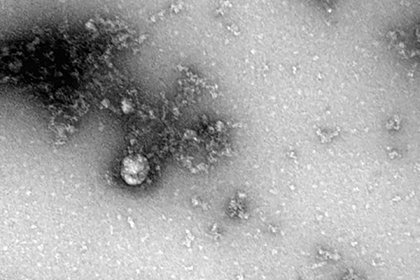 О скрытой угрозе коронавирусной инфекции предупредили россиян