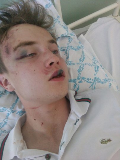 В Башкирии 18-летний парень заявил об избиении в отделе полиции