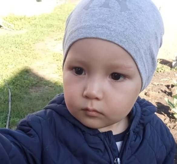 «Когда Тимур родился, сбежались все врачи»: Мальчика из Башкирии ждёт 12 операций