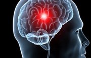 Ученые провели новый тип операции в мозге человека