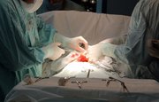 Уфимские кардиологи провели уникальную операцию по закрытию протезной фистулы на сердце