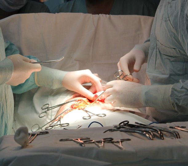 В Уфе врачи прооперировали мужчину с туберкулезным поражением позвоночника